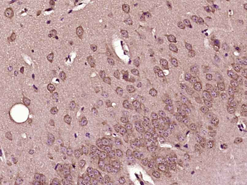 CPEB2 Rabbit Polyclonal Antibody