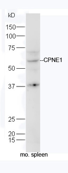CPNE1 Rabbit Polyclonal Antibody