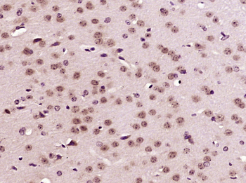 CREB5 Rabbit Polyclonal Antibody