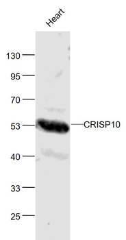 CRISP10 Rabbit Polyclonal Antibody