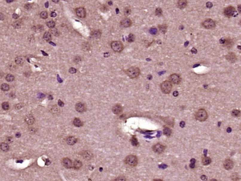 Collagen I Rabbit Polyclonal Antibody