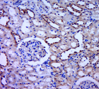 CRYBB3 Rabbit Polyclonal Antibody