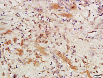 CSAG1 Rabbit Polyclonal Antibody