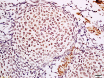 CSRP1 Rabbit Polyclonal Antibody
