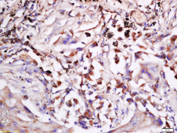 CTPS2 Rabbit Polyclonal Antibody