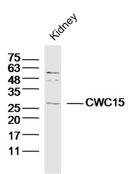 CWC15 Rabbit Polyclonal Antibody