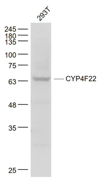 CYP4F22 Rabbit Polyclonal Antibody