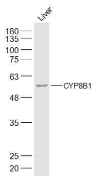 CYP8B1 Rabbit Polyclonal Antibody