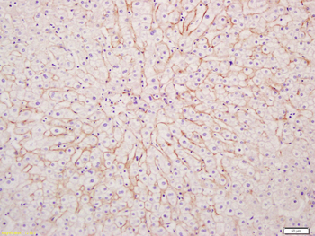 CysLT1 Rabbit Polyclonal Antibody