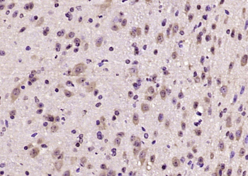 CGRP-I Rabbit Polyclonal Antibody