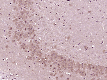 CGRP-I Rabbit Polyclonal Antibody