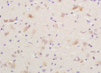 CGRP-I Rabbit Polyclonal Antibody