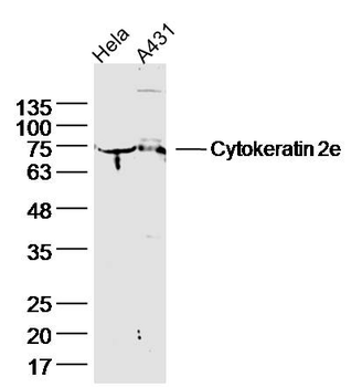 Cytokeratin 2e Rabbit Polyclonal Antibody