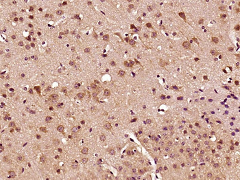 C2orf63 Rabbit Polyclonal Antibody