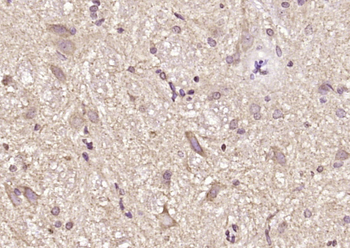 CHCHD2 Rabbit Polyclonal Antibody