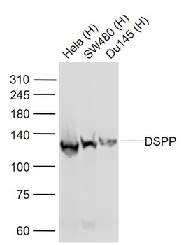 DSPP Rabbit Polyclonal Antibody