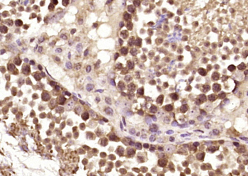 DDX55 Rabbit Polyclonal Antibody
