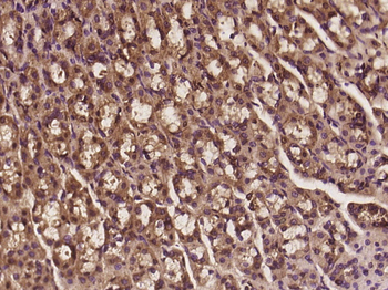 DENND3 Rabbit Polyclonal Antibody