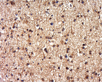 DEPDC1B/BRCC3 Rabbit Polyclonal Antibody