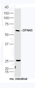DFNA5 Rabbit Polyclonal Antibody