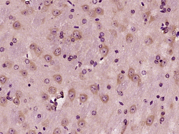 DGKB Rabbit Polyclonal Antibody
