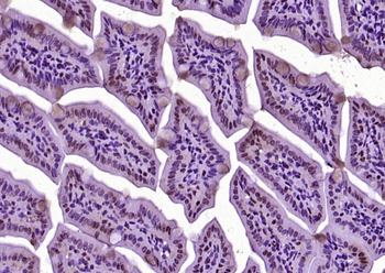 DHDH Rabbit Polyclonal Antibody