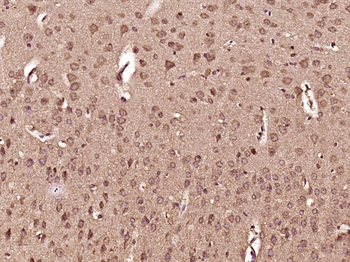 DHX36 Rabbit Polyclonal Antibody