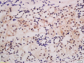 DIEXF Rabbit Polyclonal Antibody