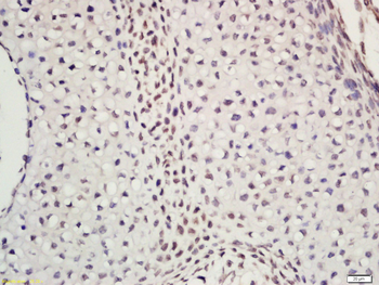 DNA Polymerase epsilon p59 Rabbit Polyclonal Antibody