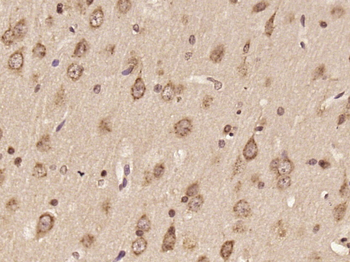DNAH6 Rabbit Polyclonal Antibody