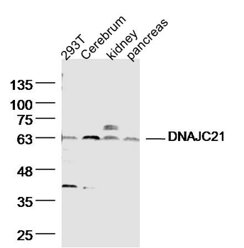 DNAJC21 Rabbit Polyclonal Antibody