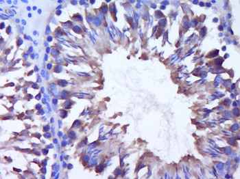 DNAJC5G Rabbit Polyclonal Antibody