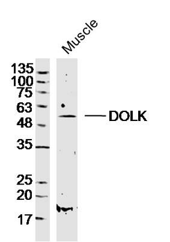 DOLK Rabbit Polyclonal Antibody