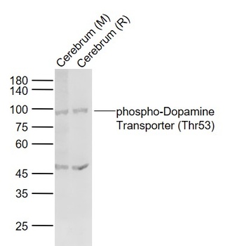 Dopamine Transporter (phospho-Thr53) antibody