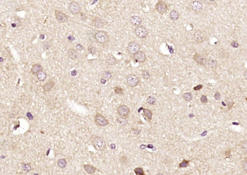 DRP2 Rabbit Polyclonal Antibody