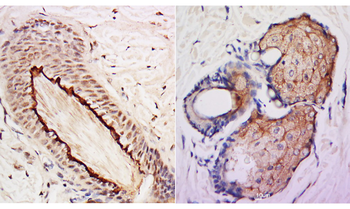 DSS1 Rabbit Polyclonal Antibody
