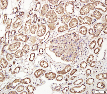 DTHD1 Rabbit Polyclonal Antibody