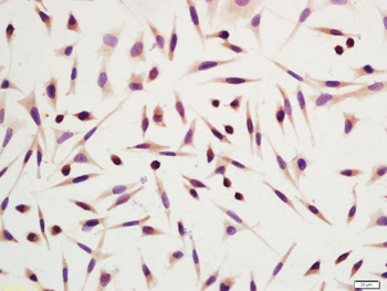 DRAM Rabbit Polyclonal Antibody