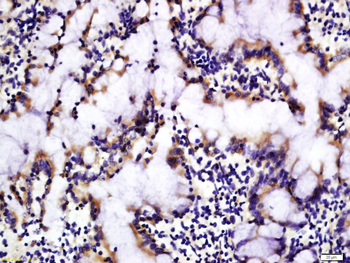 DRAM Rabbit Polyclonal Antibody