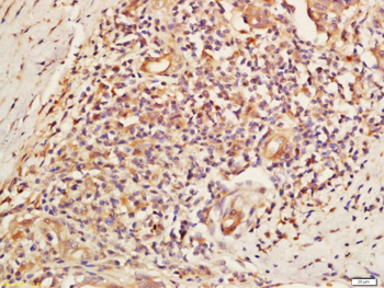 DNA Ligase III Rabbit Polyclonal Antibody
