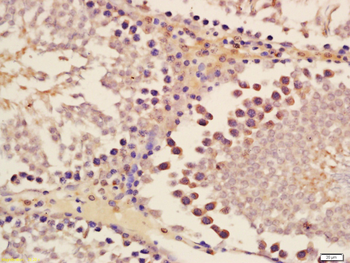 DNA Ligase III Rabbit Polyclonal Antibody