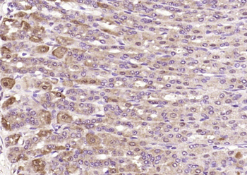 EAP30 Rabbit Polyclonal Antibody