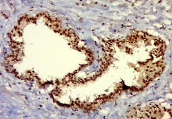 EDDM3A Rabbit Polyclonal Antibody