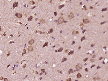 EDEM3 Rabbit Polyclonal Antibody