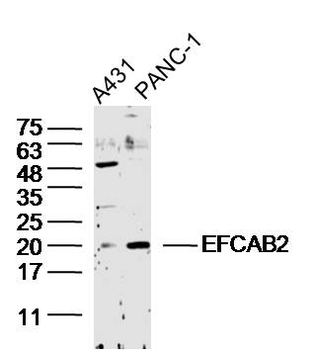 EFCAB2 Rabbit Polyclonal Antibody