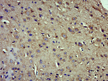 EIF3s8 Rabbit Polyclonal Antibody