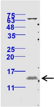 Phospho-eIF4EBP1 (Thr70) Rabbit Polyclonal Antibody