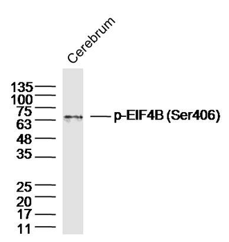 Phospho-EIF4B (Ser406) Rabbit Polyclonal Antibody