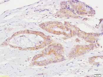 ELMO3 Rabbit Polyclonal Antibody