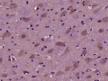 EMID1 Rabbit Polyclonal Antibody